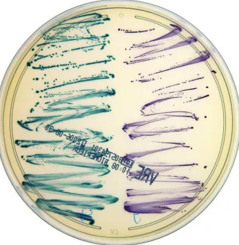 FIG. 1. VRE-BMX medium plated with E. faecalisfaeciumappear purple. For the purposes of this study, fecal specimens were plated directly to VRE-BMX and BEAV and observed for growth at and E