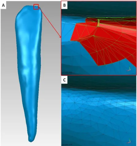 Figure 5:  Although initial geometry following segmentation can appear smooth (A), many  small defects are present that Geomagic will highlight in red using "mesh doctor" as  potentially problematic (B)