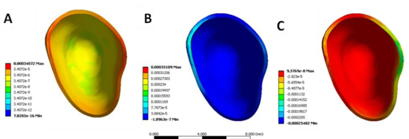 Figure 15: Equivalent (von-Mises) elastic strain (A), maximum elastic strain (B), and  minimum elastic strain (C) within the canine PDL during retraction with 1.0 N of force