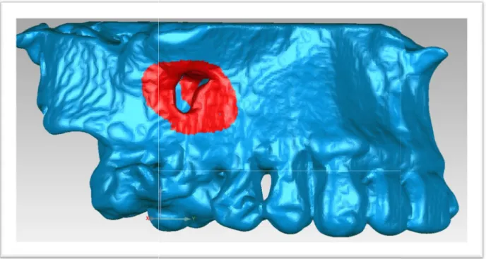 Figure  3:  Graphic  representation  of  the  time  elapsed  between  periapical  microsurgery  and the post-operative CBCT volume.