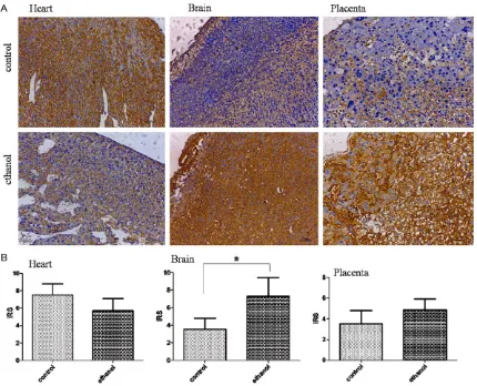 Figure 3. Igf2 expression at the mRNA level as measured with qRT-PCR in fetal mouse hearts, brains, and placentas between the ethanol-treated (n=12) and control groups (n=11)