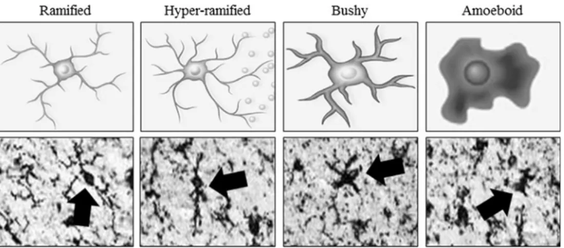 Fig. 1 Activated morphology of microglia. Representative schematics a n d p h o t o m i c r o g r a p h s o f h u m a n b r a i n m i c r o g l i a ( I b a 1 immunohistochemistry) depicting morphological stages of microglial activation