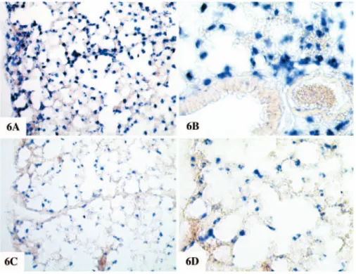 Figure 6 Non-radioactive ISH on mouse lung. Non-radioactive ISH was performed as described in Materials and Methods