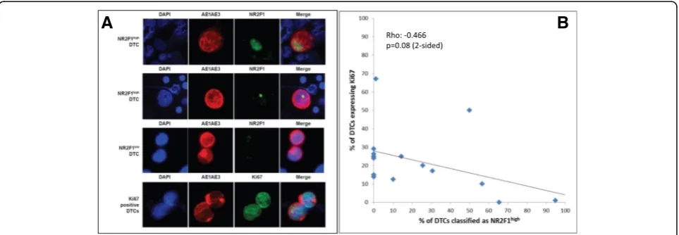 Fig. 2 Images of disseminated tumor cells (DTCs) stained by double immunofluorescence (AE1AE3/NR2F1 and AE1AE3/Ki67) and correlationbetween Ki67 and NR2F1 expression