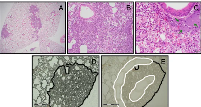 Figure 2.1: Lung lesion histology and laser capture microdissection of lesions   Representative H&amp;E stained sections of a Y