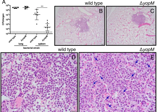 Figure 3.4: YopM-dependent effects on bacterial burden and histopathology  during pulmonary infection with Y