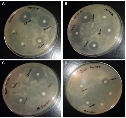 Figure S3 comparison of ZOI for different antifungal agents in groups of studied rats (A–E).Notes: (A) Control; (B) aqueous solution of formalin (7%) (irritant); (C) 50 nm rod shaped ag NPs; (D) 50 nm spherical shaped ag NPs; (E) 20 nm spherical shaped ag NPs.Abbreviation: ZOI, zones of inhibition.