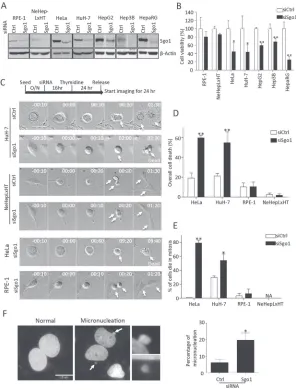 Figure 4: Sgo1 depletion reduced cell viabilities in HeLa and various hepatoma cells. (A) Endogenous levels of Sgo1 in two immortalized and five different transformed cell lines were reduced upon the depletion Sgo1 by RNA interference