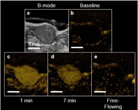 Figure 1.4. Example USMI protocol. B-mode is used for anatomical reference (a). Contrast-specific  sequences  greatly  reduce  the  tissue  signal  (b)