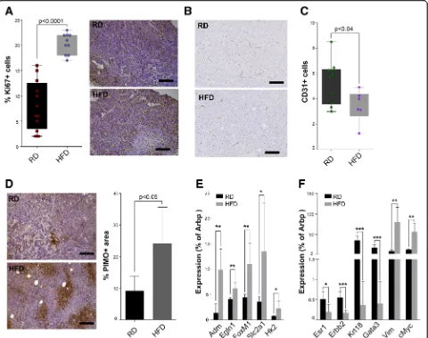Fig. 3 Increased tumor hypoxia in obese mice. Tumors in mice fed a high-fat diet (HFD) have higher Ki67+ counts (a, scalebar 200 um)