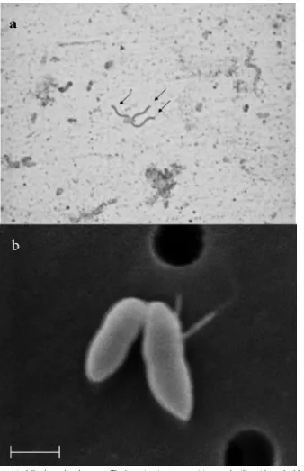 FIG. 1. Flagellum stain (a) of Catabacter hongkongensisvary in length from 0.71 to 1.12side (arrows)