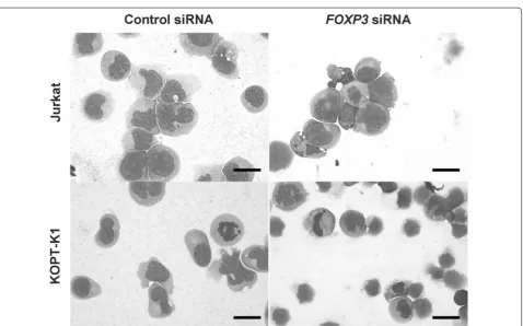 Fig. 1 Effect of FOXP3 knockdown on the growth of T-cell acute lymphoblastic leukemia cell lines