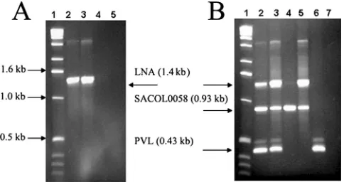 FIG. 1. Diagram showing the location of the multiplex PCR primers with reference to S