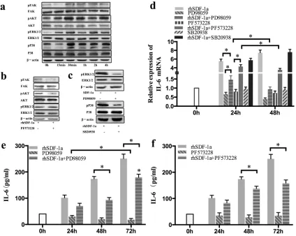 Figure 6: SDF-1α upregulated IL-6 expression in Panc-1 cells through the activation of FAK-AKT and ERK1/2 signaling
