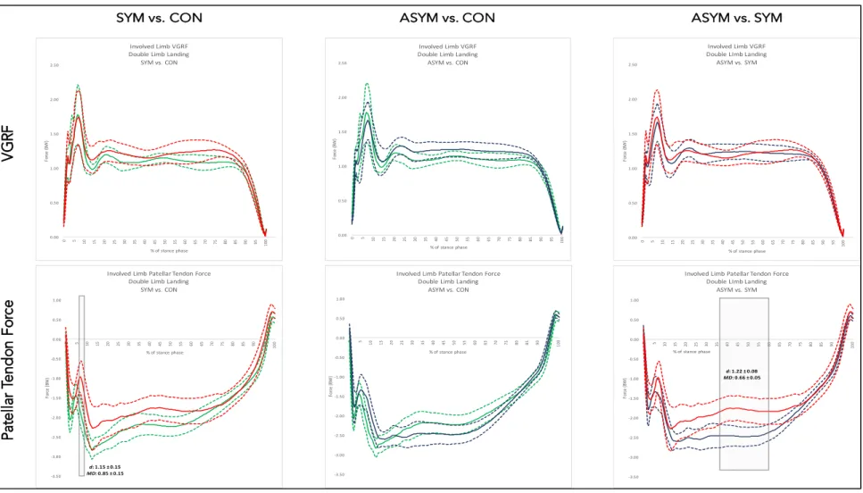 Figure 4.5: Mean and 95% confidence interval waveforms for involved limb vertical ground reaction force (VGRF) and  patellar tendon force (PTF) variables during the double-limb jump landing 