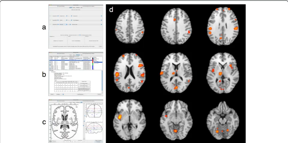 Figure 2 workspace panel for further filtering, and (c) the observed location results of theseexperiments can be visualized on a glass brain