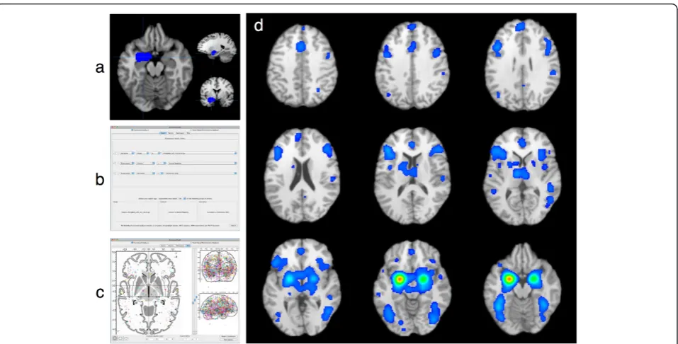 Figure 3 Procedure and Results for a Meta-Analytic Connectivity Modeling Analysisbrain