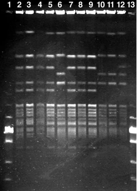 FIG. 2. PFGE of Danish outbreak isolates of Enterococcus faecalisassociated with amyloid arthropathy