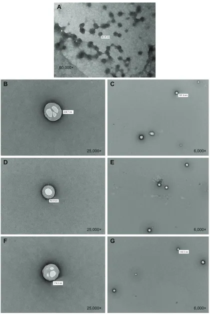 Figure 5 TeM images.Notes: (A) rNPs; (B and C) Pla10-Peg2 composite nanoparticles; (D and E) Pla25-Peg5 composite nanoparticles; and (F and G) Pla50-Peg5 composite nanoparticles