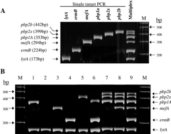 FIG. 1. New multiplex PCR assay for simultaneous detection of lytAmacrolide resistance genes [Lane M, 100-bp ladder (Amersham Biosciences)
