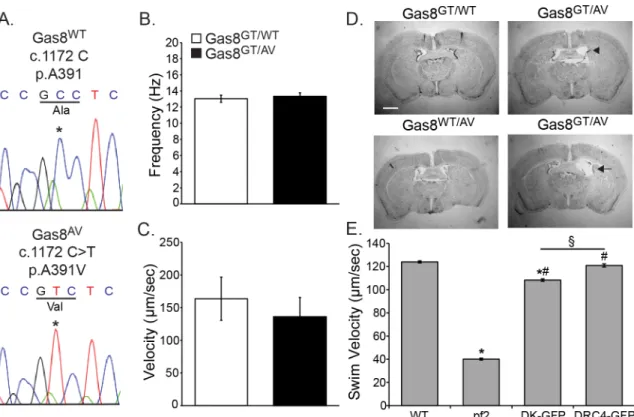 Fig 6. A391V is a potential pathogenic allele. (A) Sanger Sequence confirmation of the 1172 C >T point mutation in Gas8 AV mice reproducing the A391V missense mutation found in the human patient