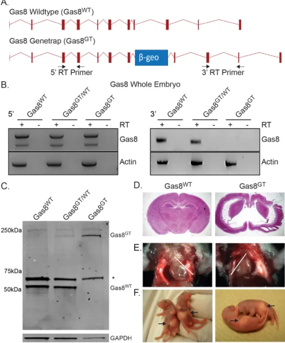 Fig 1. Generation of mutant Gas8 GT mice and phenotype description. (A) Schematic of the wildtype Gas8 allele (Gas8 WT ) and the Gas8 genetrap allele (Gas8 GT )