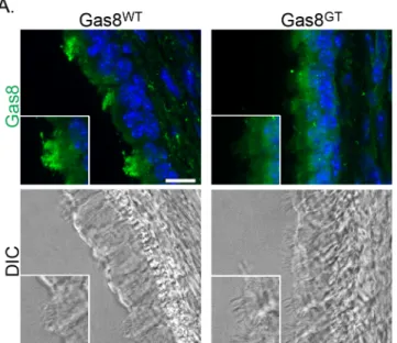 Fig 3. Gas8 localizes to cilia. Gas8 immunofluorescence staining on Gas8 WT and Gas8 GT p21 trachea (Scale Bar = 10 μm)