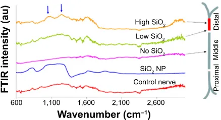 Figure 5 TEM image of the teased and dried nerve fibers, depicting a SiO2 NP.Abbreviations: NP, nanoparticle; TeM, transmission electron microscope.