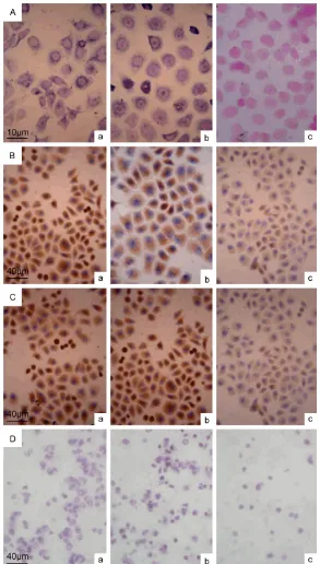 Figure 2. IHC and HE experimental results of RhoC mRNA and protein expres-sion, VEGF protein expression and Boyden chamber invasion experiment in vitro