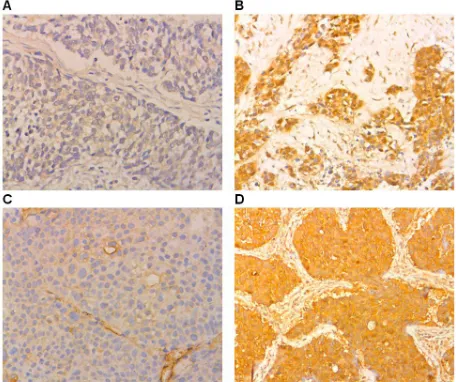 Figure 1: Immunohistochemical staining showing B7-H1 and B7-H3 expression in NSCLC and normal lung tissues (original magnification ×100)
