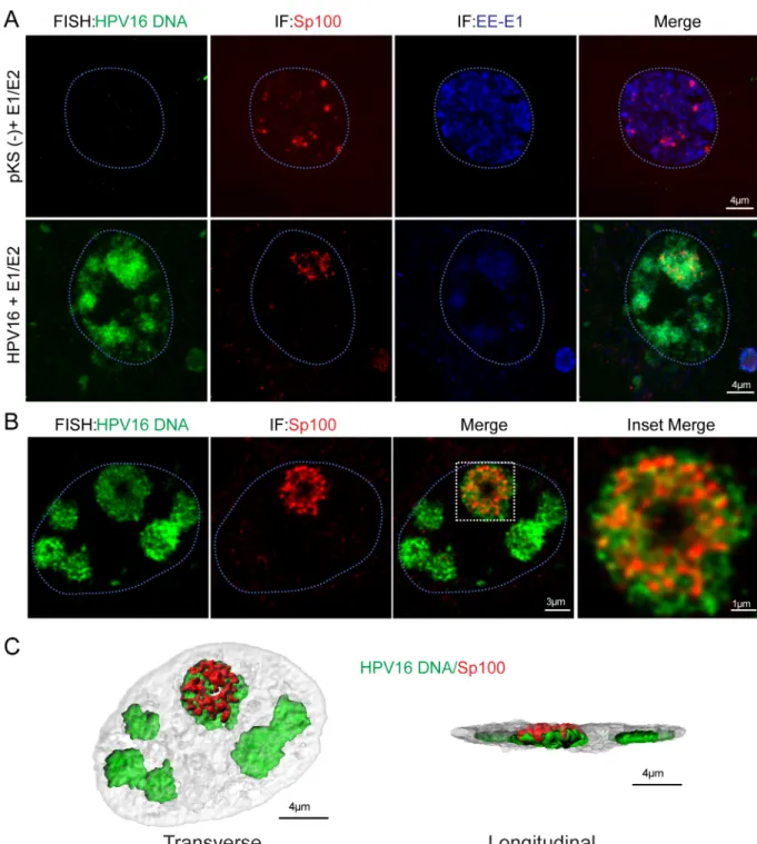 Fig 3. Sp100 is found inside viral replication factories in close association with viral DNA