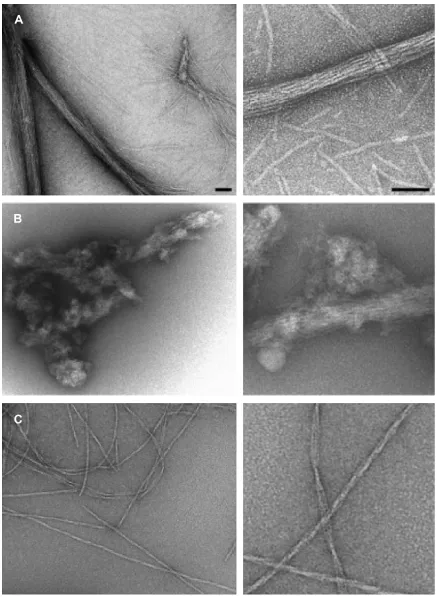 Figure 2 electron micrographs of the different Het-s PFD amyloids.Notes: (A) Amyloids formed at pH 7 and 37°C in high ionic strength consist of ordered bundles containing a variable number of 5 nm fibrils