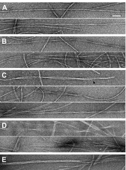 Figure 6 Structural variability of HET-s PFD pH 2 fibers with multiple single fibrils.fibril with an approximately uniform diameter (9–10 nm) and an axial repeat of 120 nm fibrils inferred to be present in these various kinds of pH 2 fibers is based on mas