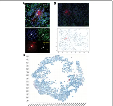 Fig. 2 AKT1QCC cluster shown inlow quiescent cancer cells (QCCs) are found in primary breast tumor tissue using quantitative immunofluorescence microscopy