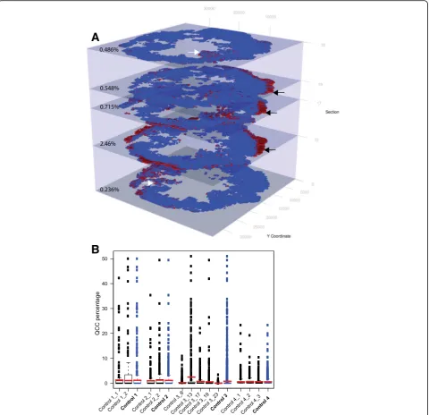 Fig. 3 AKT1density for each whole tumor sample (mean of all available sections from that tumor) is indicated by1low quiescent cancer cells (QCC) are heterogeneously and non-randomly distributed throughout primary breast tumors