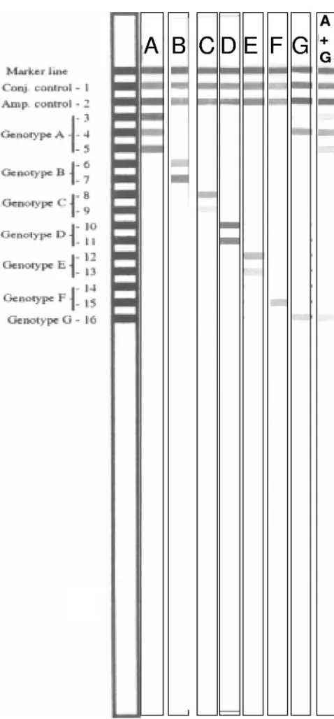 FIG. 2. InnoLipa HBV genotyping strips. On the left is a referencecard supplied by the manufacturer, then seven strips with genotypes A