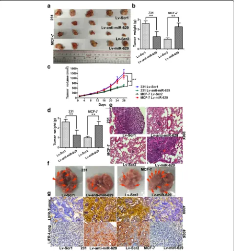 Fig. 6 miR-629-3p promotes tumorigenesis and lung metastasis of triple-negative breast cancer (TNBC).miR-629-3p-inhibiting MDA-MB-231 cells (Lv-anti-miR-629) and pre-miR-629-expressing MCF-7 cells (Lv-miR-629) were inoculated into themammary gland fat pads