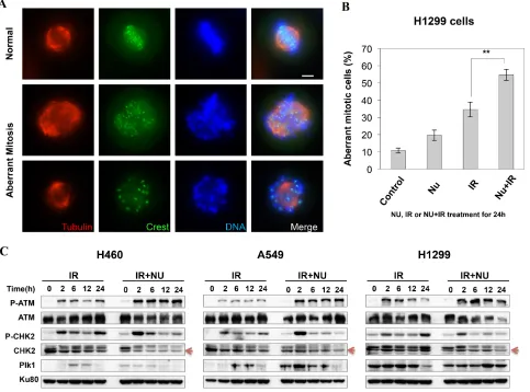 Figure 4: NU7441 + IR-induces mitotic catastrophe in H1299 cells. (A) H1299 cells were stained with anti-α-tubulin and anti-crest antibodies, the representative images show the normal and aberrant mitosis in H1299 cells