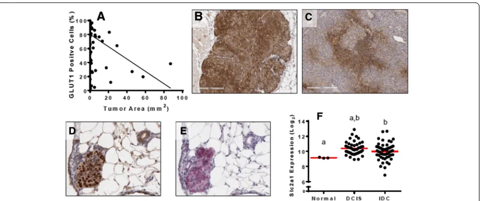 Fig. 4 GLUT1 expression decreases with increasing tumor size.( a GLUT1 protein levels are inversely correlated with tumor size