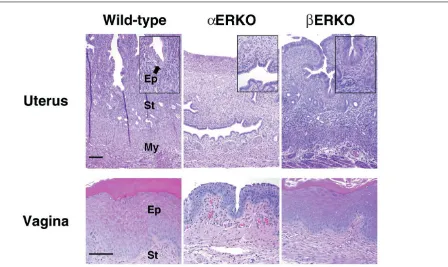 Figure 3Uterine and vaginal histology of adult ERKO mice. Histological analysis of the uterus (top panels) and vagina (bottom panels) shows the βERKOtissue is indistinguishable from the wild type, showing the normal organization of the uterine tissue into the epithelial (Ep), stromal (St) and