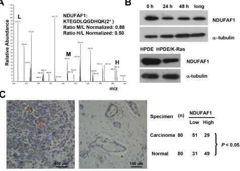 Figure 4: Suppression of NDUFAF1 expression by K-RasG12V and its low expression in pancreatic cancer tissues