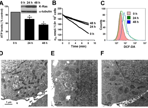 Figure 1: Expression of oncogenic K-RasG12V caused mitochondria dysfunction and metabolic alterations