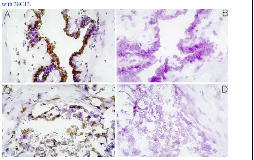 Figure 3 Immunoperoxidase Staining of mammary tissues and cell lines: Tissuesections were