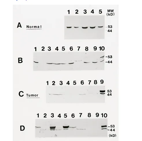 Figure 4 Immunoblot Analysis of Cell and Tissue Lysates: Lysates were made of normal humanmammaryepithelia and tumor cell lines