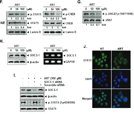 Figure 1: (Continued) (F) KBM-5 cells (1 × 106 cells/well) were treated with various indicated concentrations of ART for 4 h