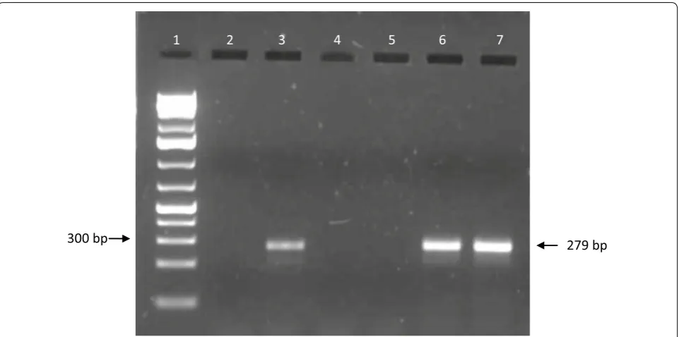 Fig. 1 1.5% agarose gel of amplified PCR products from cattle blood. Lane 1: 50–1000 bp molecular weight marker; lane 2: negative control; lane 3: positive control; lanes 6 and 7: positive samples; lanes 4 and 5: negative samples