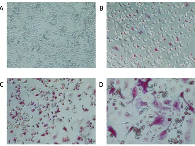 Figure 2: Representative TRAP stain of differentiating osteoclasts (20x magnification.)  A) Day 0 monocytes B)  Day 3 C) Day 6  D) Day 12 noting progressively larger cells and gain in staining intensity