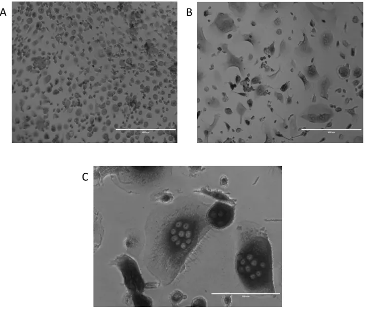 Figure 3: Representative cells at two time points.  A) Day 0 monocyte  B) Day 12 osteoclast, note multinucleated  cells  C) Day 12 osteoclast note large, multinucleated cell with ruffled borders