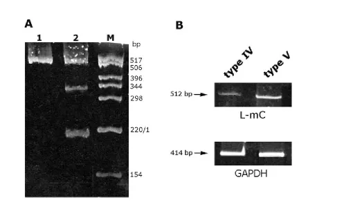 Figure 5of cDNA preparations from 8701-BC cells grown onto either type IV or type V collagen substrates inthe presence of primers specific for L-mC and GAPDH cDNA fragments