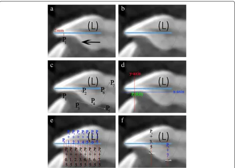 Fig. 2 a Image shows crown’s long axis (L) and its perpendicular at 2 mm (red line), point P1 (intersection of red line with PSC) and the visuallyestimated location of inflection point